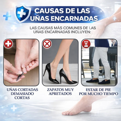 🦶 ¡Alivio Inmediato para Uñas Encarnadas y Paroniquia!